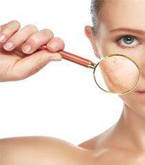 Tâches brunes sur les mains, comment les prévenir ?